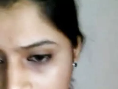बोसोमी गोरो कपाल भएक ...